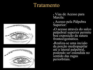 Tratamento
● Vias de Acesso para
Maxila:
● Acesso pela Pálpebra
Superior:
●O acesso através do sulco
palpebral superior permite
boa exposição da sutura
frontozigomática.
●Realiza-se uma incisão
da porção mediopupilar
até a lateral palpebral,
podendo ser estendida no
sentido das rugas
periorbitais.
 