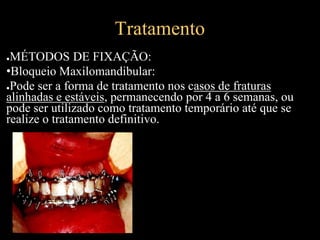 Tratamento
●MÉTODOS DE FIXAÇÃO:
•Bloqueio Maxilomandibular:
●Pode ser a forma de tratamento nos casos de fraturas
alinhadas e estáveis, permanecendo por 4 a 6 semanas, ou
pode ser utilizado como tratamento temporário até que se
realize o tratamento definitivo.
 