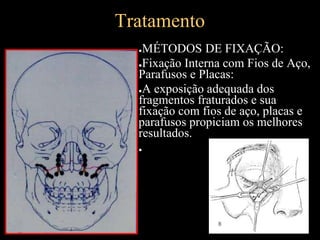 Tratamento
●MÉTODOS DE FIXAÇÃO:
●Fixação Interna com Fios de Aço,
Parafusos e Placas:
●A exposição adequada dos
fragmentos fraturados e sua
fixação com fios de aço, placas e
parafusos propiciam os melhores
resultados.
●
 