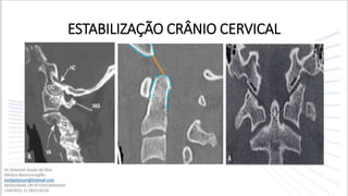 ESTABILIZAÇÃO CRÂNIO CERVICAL
 