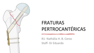 FRATURAS
PERTROCANTÉRICAS
R1- Nathália H. B. Coros
Staff- Dr Eduardo
 