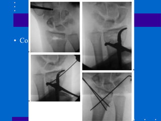 • Colocar fig 26 19 1
 