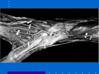 • Colocar Fig 26-20
 