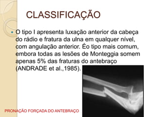 CLASSIFICAÇÃO
     O tipo I apresenta luxação anterior da cabeça
      do rádio e fratura da ulna em qualquer nível,
      com angulação anterior. Éo tipo mais comum,
      embora todas as lesões de Monteggia somem
      apenas 5% das fraturas do antebraço
      (ANDRADE et al.,1985).




PRONAÇÃO FORÇADA DO ANTEBRAÇO
 