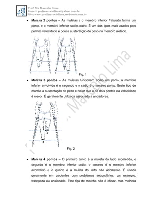 Prof. Ms. Marcelo Lima
E-mail: profmarcelolima@yahoo.com.br
Site: www.profmarcelolima.webnode.com.br
 Marcha 2 pontos – As muletas e o membro inferior fraturado forma um
ponto, e o membro inferior sadio, outro. É um dos tipos mais usados pois
permite velocidade e pouca sustentação de peso no membro afetado.
Fig. 1
 Marcha 3 pontos – As muletas funcionam como um ponto, o membro
inferior envolvido é o segundo e o sadio é o terceiro ponto. Neste tipo de
marcha a sustentação de peso é maior que a de dois pontos e a velocidade
é menor. É geralmente utilizada associada a andadores.
Fig. 2
 Marcha 4 pontos – O primeiro ponto é a muleta do lado acometido, o
segundo é o membro inferior sadio, o terceiro é o membro inferior
acometido e o quarto é a muleta do lado não acometido. É usado
geralmente em pacientes com problemas secundários, por exemplo,
franqueza ou ansiedade. Este tipo de marcha não é eficaz, mas melhora
 