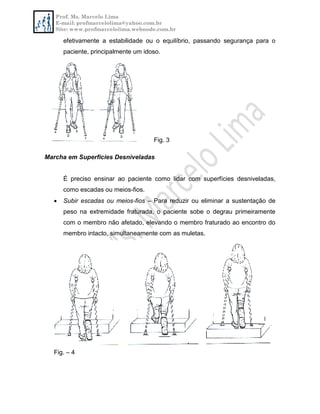 Prof. Ms. Marcelo Lima
E-mail: profmarcelolima@yahoo.com.br
Site: www.profmarcelolima.webnode.com.br
efetivamente a estabilidade ou o equilíbrio, passando segurança para o
paciente, principalmente um idoso.
Fig. 3
Marcha em Superfícies Desniveladas
É preciso ensinar ao paciente como lidar com superfícies desniveladas,
como escadas ou meios-fios.
 Subir escadas ou meios-fios – Para reduzir ou eliminar a sustentação de
peso na extremidade fraturada, o paciente sobe o degrau primeiramente
com o membro não afetado, elevando o membro fraturado ao encontro do
membro intacto, simultaneamente com as muletas.
Fig. – 4
 
