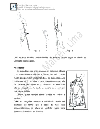 Prof. Ms. Marcelo Lima
E-mail: profmarcelolima@yahoo.com.br
Site: www.profmarcelolima.webnode.com.br
Fig. – 7 Fig – 8
Obs: Quando usadas unilateralmente as muletas devem seguir o critério de
utilização das bengalas.
Andadores
Os andadores são mais usados em pacientes idosos
com comprometimentos do equilíbrio ou do controle
motor, pois permitem uma ampla base de sustentação. As
quatro pernas do andador podem vir equipadas com pés
de borracha, pés metálicos ou rodinhas. Os andadores
são os dispositivos de auxilio a marcha que conferem
maior estabilidade.
Devem, quase sempre serem usados no padrão 3
pontos.
OBS: As bengalas, muletas e andadores devem ser
ajustados de forma que o apoio da mão fique
aproximadamente na altura do trocânter maior, para
permitir 30 de flexão de cotovelo.
 