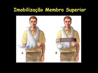 Imobilização Membro Superior
 