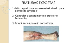 FRATURAS EXPOSTAS
1- Não reposicionar o osso exteriorizado para
dentro da cavidade;
2- Controlar o sangramento e protejer o
Ferimento;
3- Imobilizar na posição encontrada;
 