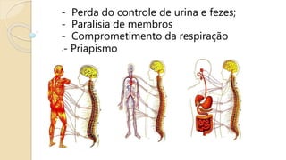 - Perda do controle de urina e fezes;
- Paralisia de membros
- Comprometimento da respiração
-- Priapismo
 