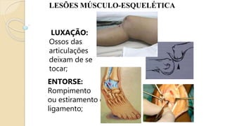 LESÕES MÚSCULO-ESQUELÉTICA
LUXAÇÃO:
Ossos das
articulações
deixam de se
tocar;
ENTORSE:
Rompimento
ou estiramento do
ligamento;
 