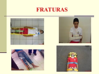 FRATURAS
 