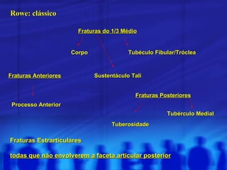 Fraturas Estrarticulares todas que não envolverem a faceta articular posterior Fraturas Anteriores Fraturas do 1/3 Médio Fraturas Posteriores Processo Anterior Corpo Sustentáculo Tali Tubéculo Fibular/Tróclea Tuberosidade Tubérculo Medial Rowe: clássico 