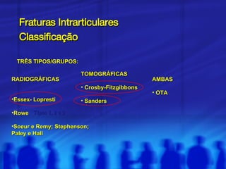 Fraturas Intrarticulares Classificação   TRÊS TIPOS/GRUPOS: RADIOGRÁFICAS Essex- Lopresti Rowe Soeur e Remy; Stephenson; Paley e Hall TOMOGRÁFICAS Crosby-Fitzgibbons Sanders AMBAS OTA Tipos 1, 2 e 3 