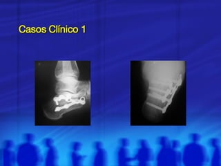 Casos Clínico 1 