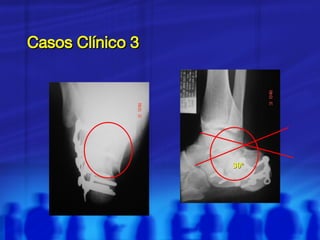 Casos Clínico 3 30º 