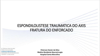 ESPONDILOLISTESE TRAUMATICA DO AXIS
FRATURA DO ENFORCADO
Peterson Xavier da Silva
Medico Residente Neurocirurgia
Hospital Santa Marcelina
 