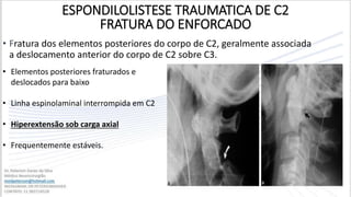 • Fratura dos elementos posteriores do corpo de C2, geralmente associada
a deslocamento anterior do corpo de C2 sobre C3.
• Elementos posteriores fraturados e
deslocados para baixo
• Linha espinolaminal interrompida em C2
• Hiperextensão sob carga axial
• Frequentemente estáveis.
ESPONDILOLISTESE TRAUMATICA DE C2
FRATURA DO ENFORCADO
 
