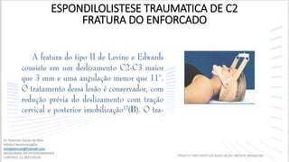 ESPONDILOLISTESE TRAUMATICA DE C2
FRATURA DO ENFORCADO
PROJETO DIRETRIZES DA ASSOCIAÇÃO MEDICA BRASILEIRA
 