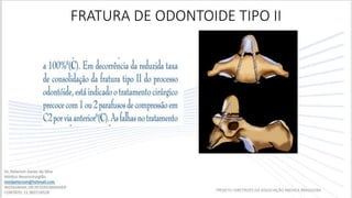 FRATURA DE ODONTOIDE TIPO II
PROJETO DIRETRIZES DA ASSOCIAÇÃO MEDICA BRASILEIRA
 