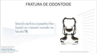 FRATURA DE ODONTOIDE
PROJETO DIRETRIZES DA ASSOCIAÇÃO MEDICA BRASILEIRA
 