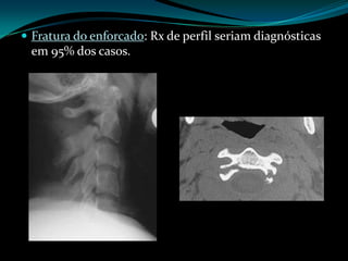  Fratura do enforcado: Rx de perfil seriam diagnósticas
 em 95% dos casos.
 