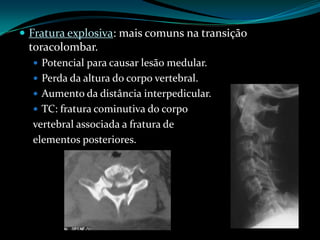  Fratura explosiva: mais comuns na transição
 toracolombar.
   Potencial para causar lesão medular.
   Perda da altura do corpo vertebral.
   Aumento da distância interpedicular.
   TC: fratura cominutiva do corpo
  vertebral associada a fratura de
  elementos posteriores.
 