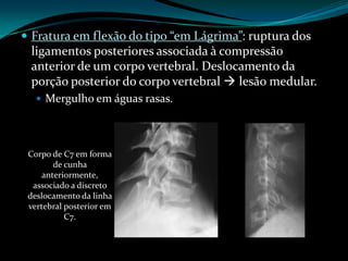  Fratura em flexão do tipo “em Lágrima”: ruptura dos
 ligamentos posteriores associada à compressão
 anterior de um corpo vertebral. Deslocamento da
 porção posterior do corpo vertebral  lesão medular.
    Mergulho em águas rasas.




 Corpo de C7 em forma
        de cunha
     anteriormente,
  associado a discreto
 deslocamento da linha
 vertebral posterior em
           C7.
 