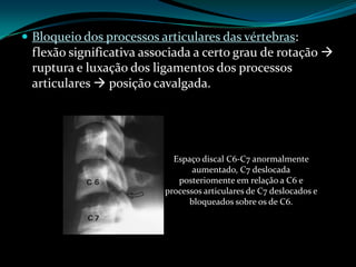  Bloqueio dos processos articulares das vértebras:
 flexão significativa associada a certo grau de rotação 
 ruptura e luxação dos ligamentos dos processos
 articulares  posição cavalgada.




                            Espaço discal C6-C7 anormalmente
                                 aumentado, C7 deslocada
                             posteriomente em relação a C6 e
                          processos articulares de C7 deslocados e
                                bloqueados sobre os de C6.
 