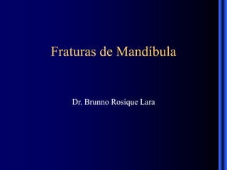 Fraturas de Mandíbula
Dr. Brunno Rosique Lara
 