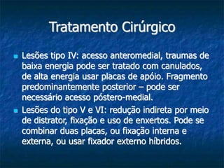 Tratamento Cirúrgico
 Lesões tipo IV: acesso anteromedial, traumas de
baixa energia pode ser tratado com canulados,
de alta energia usar placas de apóio. Fragmento
predominantemente posterior – pode ser
necessário acesso póstero-medial.
 Lesões do tipo V e VI: redução indireta por meio
de distrator, fixação e uso de enxertos. Pode se
combinar duas placas, ou fixação interna e
externa, ou usar fixador externo híbridos.
 