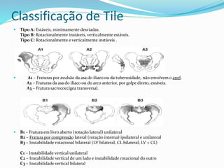 Classificação de Tile
 Tipo A: Estáveis, minimamente desviadas.
Tipo B: Rotacionalmente instáveis, verticalmente estáveis.
Tipo C: Rotacionalmente e verticalmente instáveis .
 A1 – Fraturas por avulsão da asa do ilíaco ou da tuberosidade, não envolvem o anel.
A2 – Fraturas da asa do ilíaco ou do arco anterior, por golpe direto, estáveis.
A3 – Fratura sacrococcígea transversal.
 B1 – Fratura em livro aberto (rotação lateral) unilateral
B2 – Fratura por compressão lateral (rotação interna) ipsilateral e unilateral
B3 – Instabilidade rotacional bilateral (LV bilateral, CL bilateral, LV + CL)
C1 – Instabilidade vertical unilateral
C2 – Instabilidade vertical de um lado e instabilidade rotacional do outro
C3 – Instabilidade vertical bilateral
 