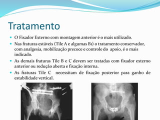 Tratamento
 O Fixador Externo com montagem anterior é o mais utilizado.
 Nas fraturas estáveis (Tile A e algumas B1) o tratamento conservador,
com analgesia, mobilização precoce e controle do apoio, é o mais
indicado.
 As demais fraturas Tile B e C devem ser tratadas com fixador externo
anterior ou redução aberta e fixação interna.
 As fraturas Tile C necessitam de fixação posterior para ganho de
estabilidade vertical.
 
