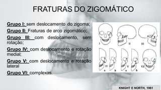 FRATURAS DO ZIGOMÁTICO
Grupo I: sem deslocamento do zigoma;
Grupo II: Fraturas de arco zigomático;
Grupo III: com deslocamento, sem
rotação;
Grupo IV: com deslocamento e rotação
medial;
Grupo V: com deslocamento e rotação
lateral
Grupo VI: complexas.
KNIGHT E NORTH, 1961
 