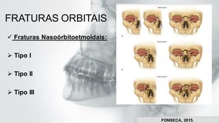 FRATURAS ORBITAIS
✓ Fraturas Nasoórbitoetmoidais:
➢ Tipo I
➢ Tipo II
➢ Tipo III
FONSECA, 2015.
 