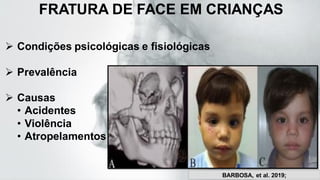 FRATURA DE FACE EM CRIANÇAS
➢ Condições psicológicas e fisiológicas
➢ Prevalência
➢ Causas
• Acidentes
• Violência
• Atropelamentos
BARBOSA, et al. 2019;
 