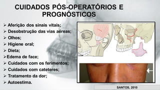 CUIDADOS PÓS-OPERATÓRIOS E
PROGNÓSTICOS
➢ Aferição dos sinais vitais;
➢ Desobstrução das vias aéreas;
➢ Olhos;
➢ Higiene oral;
➢ Dieta;
➢Edema de face;
➢ Cuidados com os ferimentos;
➢ Cuidados com cateteres;
➢ Tratamento da dor;
➢ Autoestima.
SANTOS, 2010
 