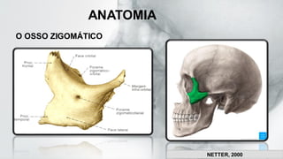 ANATOMIA
O OSSO ZIGOMÁTICO
NETTER, 2000
 