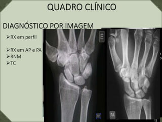 RX em perfil
RX em AP e PA
RNM
TC
 