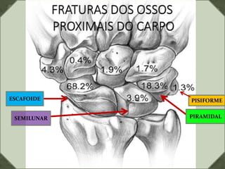ESCAFOIDE
SEMILUNAR PIRAMIDAL
PISIFORME
 