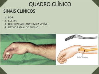 1. DOR
2. EDEMA
3. DEFORMIDADE ANATOMICA VISIÍVEL
4. DESVIO RADIAL DO PUNHO
 