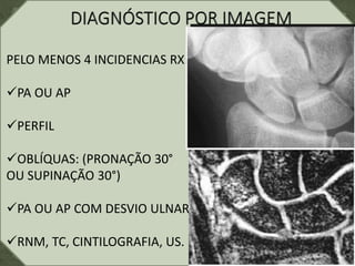 PELO MENOS 4 INCIDENCIAS RX:
PA OU AP
PERFIL
OBLÍQUAS: (PRONAÇÃO 30°
OU SUPINAÇÃO 30°)
PA OU AP COM DESVIO ULNAR
RNM, TC, CINTILOGRAFIA, US.
 