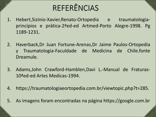 1. Hebert,Sizínio-Xavier,Renato-Ortopedia e traumatologia-
princípios e prática-2ªed-ed Artmed-Porto Alegre-1998. Pg
1189-1231.
2. Haverback,Dr Juan Fortune-Arenas,Dr Jaime Paulos-Ortopedia
y Traumatologia-Faculdade de Medicina de Chile.fonte
Dreamule.
3. Adams,John Crawford-Hamblen,Davi L.-Manual de Fraturas-
10ªed-ed Artes Medicas-1994.
4. https://traumatologiaeortopedia.com.br/viewtopic.php?t=285.
5. As imagens foram encontradas na página https://google.com.br
 