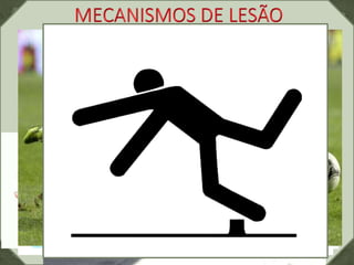 O TRAUMA PODE SER CAUSADO POR
TROPEÇO SEGUIDO DE QUEDA COM AÇÃO
REFLEXA DE IMPOSIÇÃO DAS MÃOS. A
MAIORIA DAS QUEDAS SÃO DOMÉSTICAS
SEGUIDAS DE LESÕES NO ESPORTE.
 