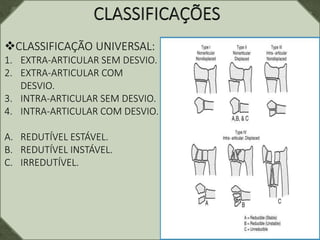 CLASSIFICAÇÃO UNIVERSAL:
1. EXTRA-ARTICULAR SEM DESVIO.
2. EXTRA-ARTICULAR COM
DESVIO.
3. INTRA-ARTICULAR SEM DESVIO.
4. INTRA-ARTICULAR COM DESVIO.
A. REDUTÍVEL ESTÁVEL.
B. REDUTÍVEL INSTÁVEL.
C. IRREDUTÍVEL.
 