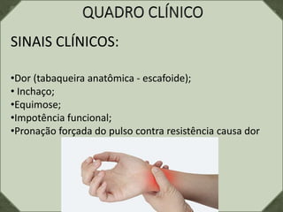 SINAIS CLÍNICOS:
•Dor (tabaqueira anatômica - escafoide);
• Inchaço;
•Equimose;
•Impotência funcional;
•Pronação forçada do pulso contra resistência causa dor
 