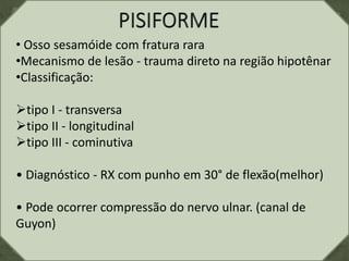 • Osso sesamóide com fratura rara
•Mecanismo de lesão - trauma direto na região hipotênar
•Classificação:
tipo I - transversa
tipo II - longitudinal
tipo III - cominutiva
• Diagnóstico - RX com punho em 30° de flexão(melhor)
• Pode ocorrer compressão do nervo ulnar. (canal de
Guyon)
 