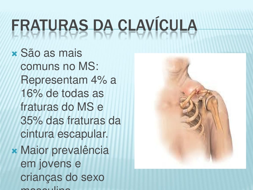 Estudo Electromiográfico Dos Membros Superiores E Inferiores