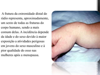 A fratura da extremidade distal do
rádio representa, aproximadamente,
um sexto de todas as fraturas do
corpo humano, sendo a mais
comum delas. A incidência depende
da idade e do sexo devido à maior
exposição a atividades perigosas
em jovens do sexo masculino e à
pior qualidade do osso nas
mulheres após a menopausa.
 