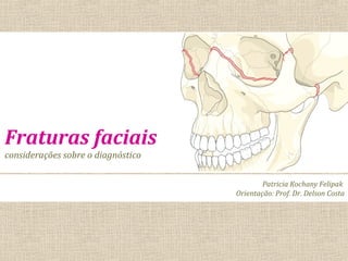 Fraturas faciais
considerações sobre o diagnóstico
Patricia Kochany Felipak
Orientação: Prof. Dr. Delson Costa
 